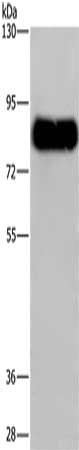 Gel: 6%SDS-PAGE, Lysate: 40 μg, Lane: Mouse brain tissue, Primary antibody: SYN1 Antibody(SYN1 Antibody) at dilution 1/650, Secondary antibody: Goat anti rabbit IgG at 1/8000 dilution, Exposure time: 20 secondsRabbit anti-Human SYN1 Polyclonal Antibody