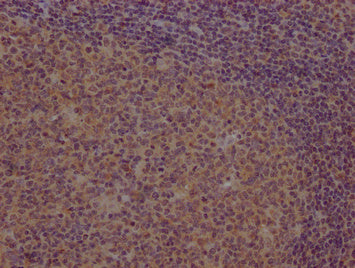 IHC image of PCDHB7 Antibody diluted at 1:100 and staining in paraffin-embedded human tonsil tissue performed on a Leica BondTM system. After dewaxing and hydration, antigen retrieval was mediated by high pressure in a citrate buffer (pH 6.0). Section was blocked with 10% normal goat serum 30min at RT. Then primary antibody (1% BSA) was incubated at 4°C overnight. The primary is detected by a Goat anti-rabbit polymer IgG labeled by HRP and visualized using 0.05% DAB.Rabbit anti-Human PCDHB7 Polyclonal Antibody