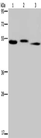 Gel: 8%SDS-PAGE, Lysate: 40 μg, Lane 1-3: Human kidney tissue, HepG2 cells, human testis tissue, Primary antibody: HYAL3 Antibody(HYAL3 Antibody) at dilution 1/400, Secondary antibody: Goat anti rabbit IgG at 1/8000 dilution, Exposure time: 1 minuteRabbit anti-Human HYAL3 Polyclonal Antibody