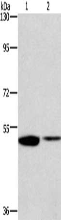 Gel: 8%SDS-PAGE, Lysate: 40 μg, Lane 1-2: Mouse kidney tissue, Mouse lung tissue, Primary antibody: IRF6 Antibody(IRF6 Antibody) at dilution 1/200, Secondary antibody: Goat anti rabbit IgG at 1/8000 dilution, Exposure time: 2 minutes