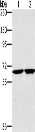 Gel: 6%SDS-PAGE, Lysate: 40 μg, Lane 1-2: Huvec cells, K562 cells, Primary antibody: HSD17B4 Antibody(HSD17B4 Antibody) at dilution 1/200, Secondary antibody: Goat anti rabbit IgG at 1/8000 dilution, Exposure time: 10 secondsRabbit anti-Human HSD17B4 Polyclonal Antibody