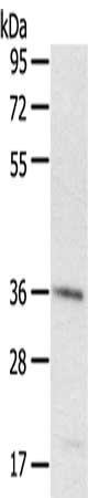 Gel: 8%SDS-PAGE, Lysate: 40 μg, Lane: A431 cells, Primary antibody: PDLIM4 Antibody(PDLIM4 Antibody) at dilution 1/400, Secondary antibody: Goat anti rabbit IgG at 1/8000 dilution, Exposure time: 3 secondsRabbit anti-Human PDLIM4 Polyclonal Antibody