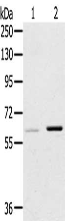 Gel: 8%SDS-PAGE, Lysate: 40 μg, Lane 1-2: 293T cells, A431 cells, Primary antibody: ME1 Antibody(ME1 Antibody) at dilution 1/200, Secondary antibody: Goat anti rabbit IgG at 1/8000 dilution, Exposure time: 15 seconds