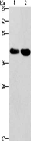 Gel: 10%SDS-PAGE, Lysate: 40 μg, Lane 1-2: Raji cells, 293T cells, Primary antibody: STK17A Antibody(STK17A  Antibody) at dilution 1/900, Secondary antibody: Goat anti rabbit IgG at 1/8000 dilution, Exposure time: 1 minuteRabbit anti-Human STK17A Polyclonal Antibody