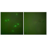 Immunofluorescence analysis of HeLa cells, using p14 ARF antibody.Rabbit anti-Human CDKN2A Polyclonal Antibody