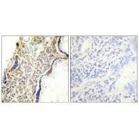 Immunohistochemical analysis of paraffin-embedded human placenta tissue using p14 ARF antibody.Rabbit anti-Human CDKN2A Polyclonal Antibody