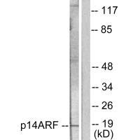 Western blot analysis of extracts from HeLa cells, using p14 ARF antibody.Rabbit anti-Human CDKN2A Polyclonal Antibody
