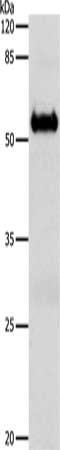Gel: 10%SDS-PAGE, Lysate: 30 μg, Lane: Mouse brain tissue, Primary antibody: SLC1A6 Antibody(SLC1A6 Antibody) at dilution 1/600, Secondary antibody: Goat anti rabbit IgG at 1/8000 dilution, Exposure time: 1 minuteRabbit anti-Human SLC1A6 Polyclonal Antibody