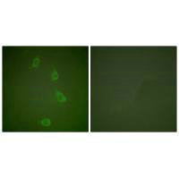 Immunofluorescence analysis of NIH/3T3 cells, using HSP40 antibody.Rabbit anti-Human DNAJB1 Polyclonal Antibody