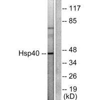 Western blot analysis of extracts from COLO205 cells, using HSP40 antibody.Rabbit anti-Human DNAJB1 Polyclonal Antibody