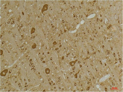 Immunohistochemical analysis of paraffin-embedded Rat BrainTissue using GABA A Receptor γ2 Rabbit pAb diluted at 1:200.Rabbit anti-Human GABRG2 Polyclonal Antibody