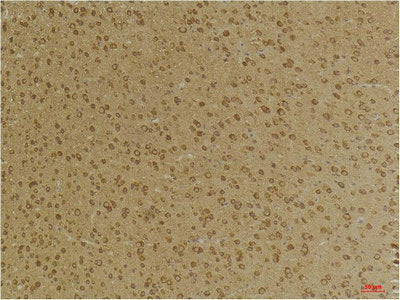 Immunohistochemical analysis of paraffin-embedded Mouse BrainTissue using GABA A Receptor γ2 Rabbit pAb diluted at 1:200.Rabbit anti-Human GABRG2 Polyclonal Antibody