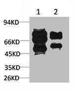 Western blot analysis of 1) Mouse Brain Tissue, 2)Rat Brain Tissue with GABA A Receptor γ2 Rabbit pAb diluted at 1:2,000.Rabbit anti-Human GABRG2 Polyclonal Antibody