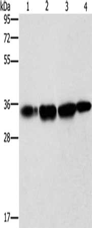 Gel: 10%SDS-PAGE, Lysate: 40 μg, Lane 1-4: Hela cells, human prostate tissue, A172 cells, mouse liver tissue tissue, Primary antibody: NDNL2 Antibody(NDNL2 Antibody) at dilution 1/1500, Secondary antibody: Goat anti rabbit IgG at 1/8000 dilution, Exposure time: 40 secondsRabbit anti-Human NDNL2 Polyclonal Antibody