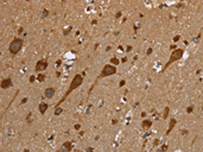 The image on the left is immunohistochemistry of paraffin-embedded Human brain tissue using the antibody Antibody) at dilution 1/50, on the right is treated with fusion protein. (Original magnification: ×200)Rabbit anti-Human TRIM29 Polyclonal Antibody