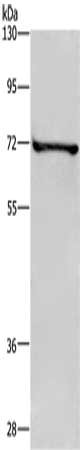 Gel: 8%SDS-PAGE, Lysate: 40 μg, Lane: HT29 cells, Primary antibody: TRIM29 Antibody(TRIM29 Antibody) at dilution 1/400, Secondary antibody: Goat anti rabbit IgG at 1/8000 dilution, Exposure time: 10 secondsRabbit anti-Human TRIM29 Polyclonal Antibody