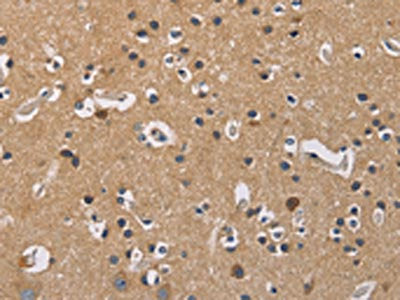 The image on the left is immunohistochemistry of paraffin-embedded Human brain tissue using the antibody Antibody) at dilution 1/20, on the right is treated with fusion protein. (Original magnification: ×200)Rabbit anti-Human GNB5 Polyclonal Antibody