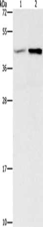 Gel: 15%SDS-PAGE, Lysate: 40 μg, Lane 1-2: Human fetal brain tissue, mouse heart tissue, Primary antibody: GNB5 Antibody(GNB5 Antibody) at dilution 1/550, Secondary antibody: Goat anti rabbit IgG at 1/8000 dilution, Exposure time: 1 secondRabbit anti-Human GNB5 Polyclonal Antibody