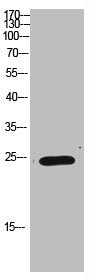 Western Blot analysis of HEPG2 cells using Antibody diluted at 1000. Secondary antibody  was diluted at 1:20000Rabbit anti-Human IMP3 Polyclonal Antibody