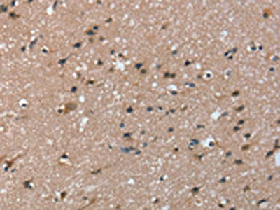 The image on the left is immunohistochemistry of paraffin-embedded Human brain tissue using the antibody Antibody) at dilution 1/20, on the right is treated with fusion protein. (Original magnification: ×200)Rabbit anti-Human TRIM31 Polyclonal Antibody