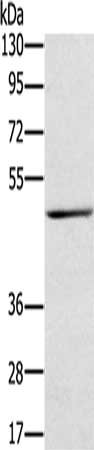 Gel: 8%SDS-PAGE, Lysate: 40 μg, Lane: Human stomach cancer tissue, Primary antibody: TRIM31 Antibody(TRIM31 Antibody) at dilution 1/250, Secondary antibody: Goat anti rabbit IgG at 1/8000 dilution, Exposure time: 5 minutesRabbit anti-Human TRIM31 Polyclonal Antibody