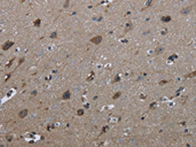 The image on the left is immunohistochemistry of paraffin-embedded Human brain  tissue using FAM89B Antibody(FAM89B Antibody) at dilution 1/30, on the right is treated with fusion protein. (Original magnification: ×200)