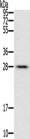 Gel: 12%SDS-PAGE, Lysate: 40 μg, Lane: Mouse liver tissue, Primary antibody: FAM89B Antibody(FAM89B Antibody) at dilution 1/400, Secondary antibody: Goat anti rabbit IgG at 1/8000 dilution, Exposure time: 10 seconds