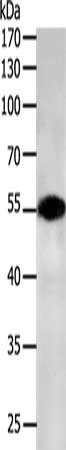 Gel: 10%SDS-PAGE, Lysate: 50 μg, Lane: NIH/3T3 cells, Primary antibody: CASP12 Antibody(CASP12 Antibody) at dilution 1/700, Secondary antibody: Goat anti rabbit IgG at 1/8000 dilution, Exposure time: 2 minutes