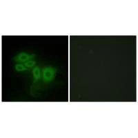 Immunofluorescence analysis of HepG2 cells, using SLK antibody.Rabbit anti-Human SLK Polyclonal Antibody