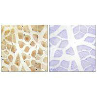 Immunohistochemistry analysis of paraffin-embedded human skeletal muscle tissue using SLK antibody.Rabbit anti-Human SLK Polyclonal Antibody
