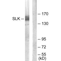 Western blot analysis of extracts from COLO205 cells, using SLK antibody.Rabbit anti-Human SLK Polyclonal Antibody
