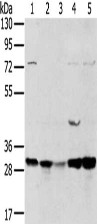 Gel: 8%SDS-PAGE, Lysate: 40 μg, Lane 1-5: 293T cells, MCF7 cells, mouse brain tissue, K562 cells, mouse bladder tissue, Primary antibody: TPD52L2 Antibody(TPD52L2 Antibody) at dilution 1/400, Secondary antibody: Goat anti rabbit IgG at 1/8000 dilution, Exposure time: 20 secondsRabbit anti-Human TPD52L2 Polyclonal Antibody