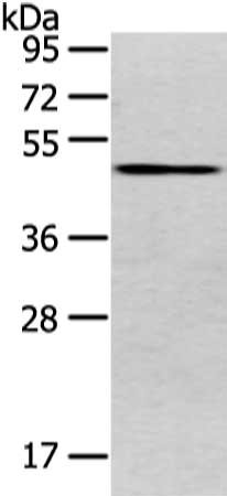 Gel: 8%SDS-PAGE, Lysate: 80 μg, Lane: 293T cell, Primary antibody: VMP1 Antibody(VMP1 Antibody) at dilution 1/800 dilution, Secondary antibody: Goat anti rabbit IgG at 1/8000 dilution, Exposure time: 1 minuteRabbit anti-Human VMP1 Polyclonal Antibody
