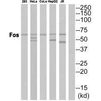 Western blot analysis of extracts from HepG2 cells, using Fos antibody.Rabbit anti-Human FOS Polyclonal Antibody