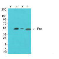 Western blot analysis of extracts from A549 cells (Lane 2), Hela cells (Lane 3) and JK cells (Lane 4), using Fos antiobdy. The lane on the left is treated with synthesized peptide.Rabbit anti-Human FOS Polyclonal Antibody