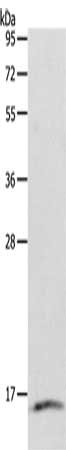 Gel: 12%SDS-PAGE, Lysate: 40 μg, Lane: Human fetal lung tissue, Primary antibody: LYZ Antibody(LYZ Antibody) at dilution 1/200, Secondary antibody: Goat anti rabbit IgG at 1/8000 dilution, Exposure time: 45 seconds