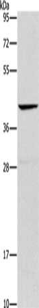 Gel: 10%SDS-PAGE, Lysate: 40 μg, Lane: Mouse liver tissue, Primary antibody: ORM2 Antibody(ORM2 Antibody) at dilution 1/500, Secondary antibody: Goat anti rabbit IgG at 1/8000 dilution, Exposure time: 10 secondsRabbit anti-Human ORM2 Polyclonal Antibody