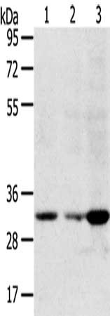 Gel: 10%SDS-PAGE, Lysate: 40 μg, Lane 1-3: 293T cells, hepg2 cells, human fetal liver tissue, Primary antibody: CCS Antibody(CCS Antibody) at dilution 1/250, Secondary antibody: Goat anti rabbit IgG at 1/8000 dilution, Exposure time: 2 minutesRabbit anti-Human CCS Polyclonal Antibody