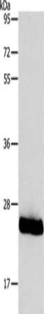 Gel: 10%SDS-PAGE, Lysate: 40 μg, Lane: Mouse trachea tissue, Primary antibody: PPAP2C Antibody(PPAP2C Antibody) at dilution 1/800, Secondary antibody: Goat anti rabbit IgG at 1/8000 dilution, Exposure time: 20 secondsRabbit anti-Human PPAP2C Polyclonal Antibody