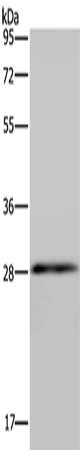 Gel: 10%SDS-PAGE, Lysate: 40 μg, Lane: Mouse skin tissue, Primary antibody: GJB4 Antibody(GJB4 Antibody) at dilution 1/200, Secondary antibody: Goat anti rabbit IgG at 1/8000 dilution, Exposure time: 5 minutesRabbit anti-Human GJB4 Polyclonal Antibody