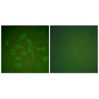 Immunofluorescence analysis of HepG2 cells, using Mammaglobin antibody.Rabbit anti-Human SCGB2A2 Polyclonal Antibody