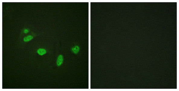 Immunofluorescence staining of methanol-fixed HeLa cells using ETS1 (Phospho-Thr38) Antibody.Rabbit anti-Mus musculus (Mouse) Ets1 Polyclonal Antibody
