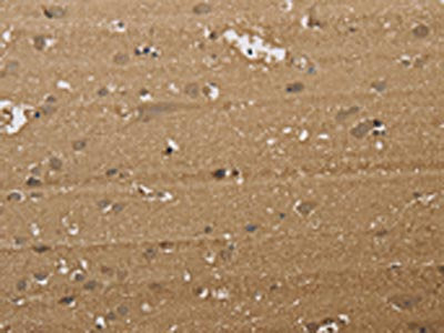 The image on the left is immunohistochemistry of paraffin-embedded Human brain tissue using the antibody Antibody) at dilution 1/40, on the right is treated with synthetic peptide. (Original magnification: ×200)