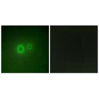 Immunofluorescence analysis of HUVEC cells, using LRAT antibody.