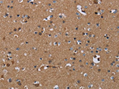 The image on the left is immunohistochemistry of paraffin-embedded Human brain  tissue using PDE4A Antibody(PDE4A Antibody) at dilution 1/40, on the right is treated with synthetic peptide. (Original magnification: ×200)Rabbit anti-Human PDE4A Polyclonal Antibody