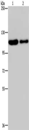 Gel: 6%SDS-PAGE, Lysate: 40 μg, Lane 1-2: Hela cells, A172 cells, Primary antibody: PDE4A Antibody(PDE4A Antibody) at dilution 1/300, Secondary antibody: Goat anti rabbit IgG at 1/8000 dilution, Exposure time: 20 secondsRabbit anti-Human PDE4A Polyclonal Antibody