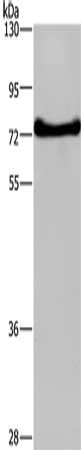 Gel: 8%SDS-PAGE, Lysate: 40 μg, Lane: HepG2 cells, Primary antibody: DDX43 Antibody(DDX43 Antibody) at dilution 1/200, Secondary antibody: Goat anti rabbit IgG at 1/8000 dilution, Exposure time: 3 minutesRabbit anti-Human DDX43 Polyclonal Antibody