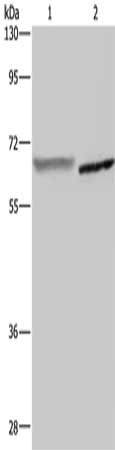 Gel: 8%SDS-PAGE, Lysate: 40 μg, Lane 1-2: Human placenta tissue, mouse liver tissue, Primary antibody: GCKR Antibody(GCKR Antibody) at dilution 1/400, Secondary antibody: Goat anti rabbit IgG at 1/8000 dilution, Exposure time: 2 minutesRabbit anti-Human GCKR Polyclonal Antibody