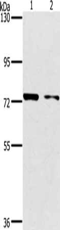 Gel: 6%SDS-PAGE, Lysate: 40 μg, Lane 1-2: MCF7 cells, hela cells, Primary antibody: PPP1R13L Antibody(PPP1R13L Antibody) at dilution 1/500, Secondary antibody: Goat anti rabbit IgG at 1/8000 dilution, Exposure time: 30 secondsRabbit anti-Human PPP1R13L Polyclonal Antibody
