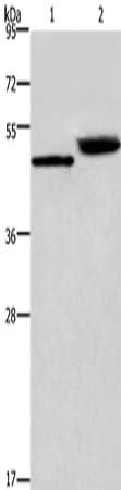 Gel: 8%SDS-PAGE, Lysate: 40 μg, Lane 1-2: Human stomach cancer tissue, mouse stomach tissue, Primary antibody: CTSE Antibody(CTSE Antibody) at dilution 1/450, Secondary antibody: Goat anti rabbit IgG at 1/8000 dilution, Exposure time: 20 secondsRabbit anti-Human CTSE Polyclonal Antibody